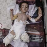 Peuters in Gaza Kregen Polio Vaccin, Maar Verloren Hun Benen Door Israëlische Bombardementen