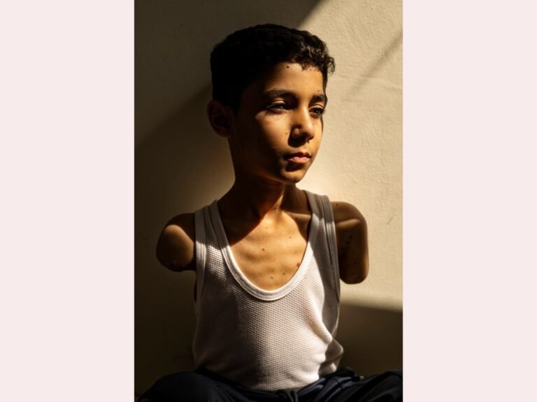 Portret van geamputeerde Palestijnse jongen uit Gaza wint World Press Photo Award