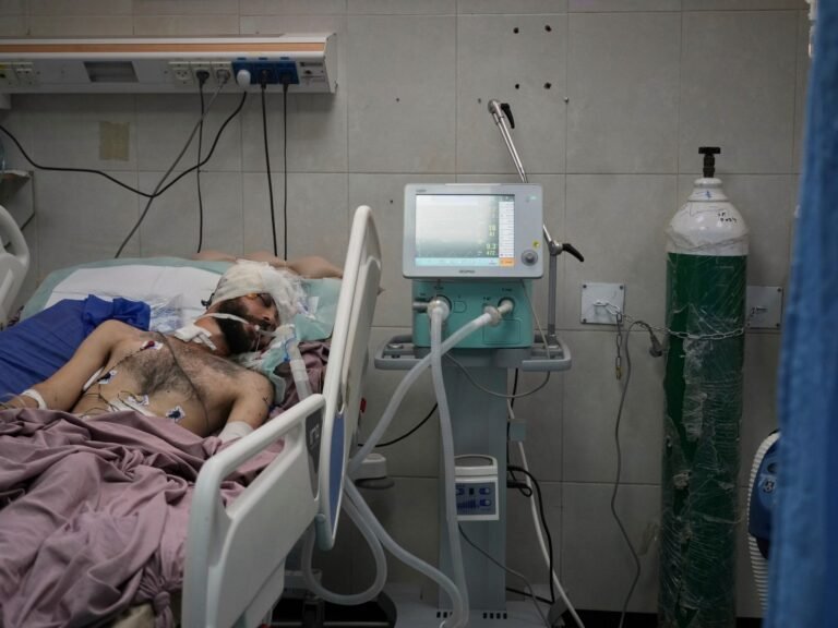 Foto's: Ziekenhuizen in Gaza kunnen geen voedsel bieden aan herstellende patiënten