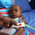 Malnutritie in Nigeria eist leven van 652 kinderen in de afgelopen zes maanden