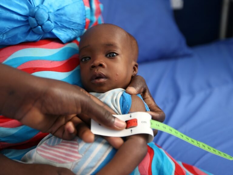 Malnutritie in Nigeria eist leven van 652 kinderen in de afgelopen zes maanden