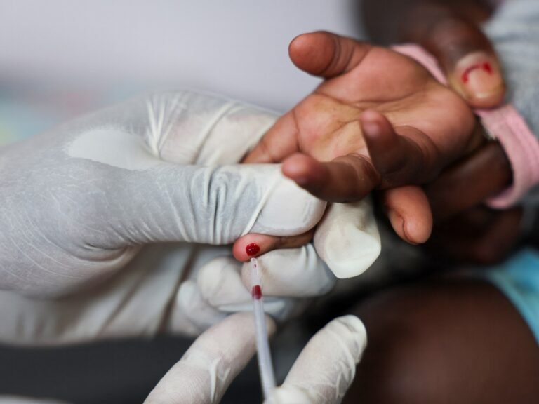 VS-hulpcuts kunnen tegen 2029 miljoenen extra HIV/AIDS-doden veroorzaken, waarschuwt de VN