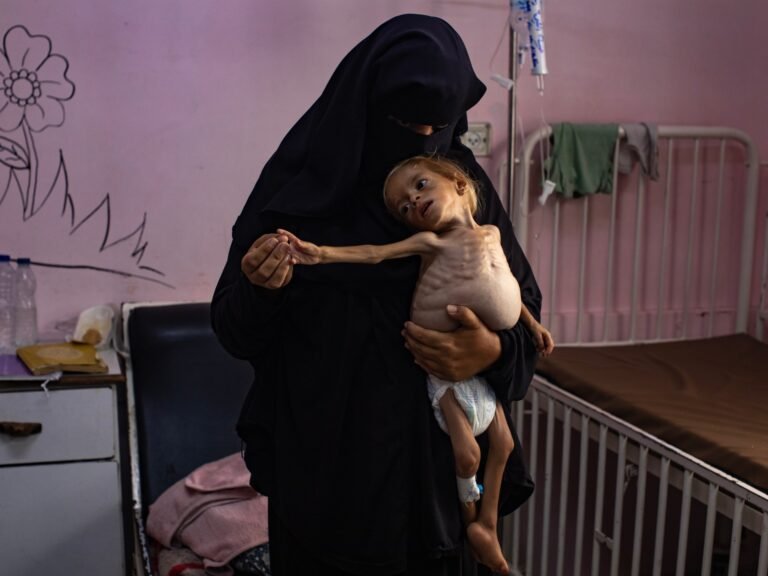 Week in Beelden: Van de door Israël veroorzaakte hongersnood in Gaza tot bosbranden in Spanje
