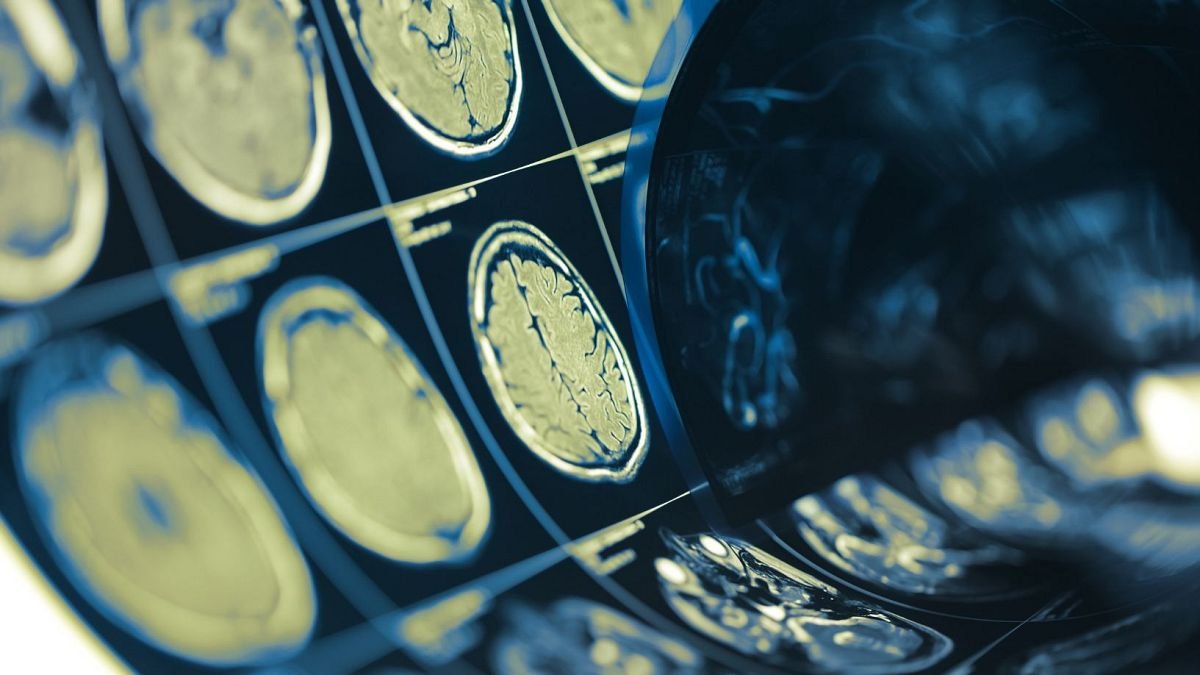 Brein-computerchip kan gedachten van mensen met tot 74% nauwkeurigheid lezen