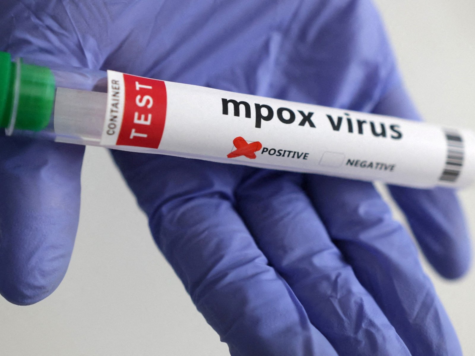 Mpox niet langer internationale gezondheidsnood, maar blijft zorg in Afrika