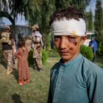 Naschokken Verergeren Letsels Na Hevige Aardbeving in Afghanistan