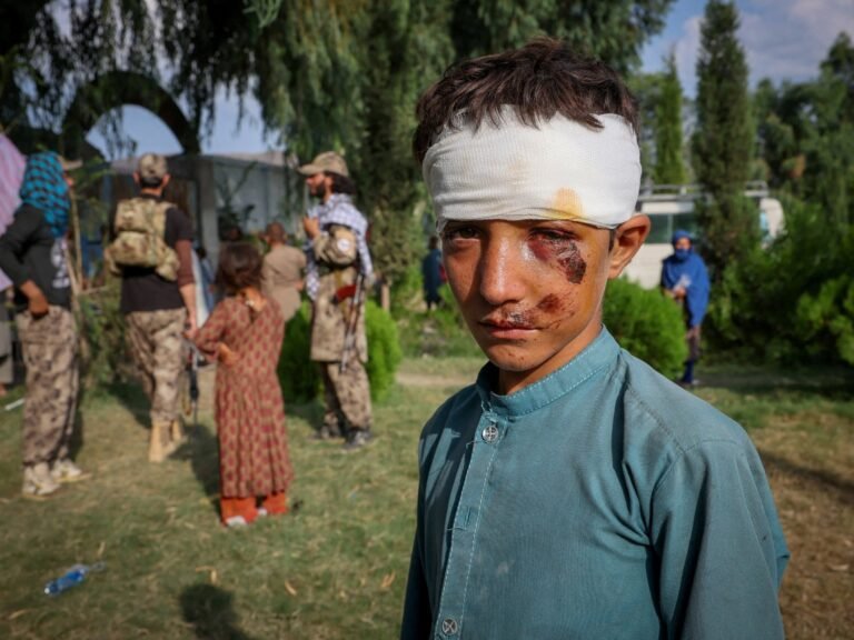 Naschokken Verergeren Letsels Na Hevige Aardbeving in Afghanistan